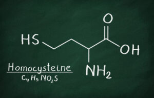 homocysteina