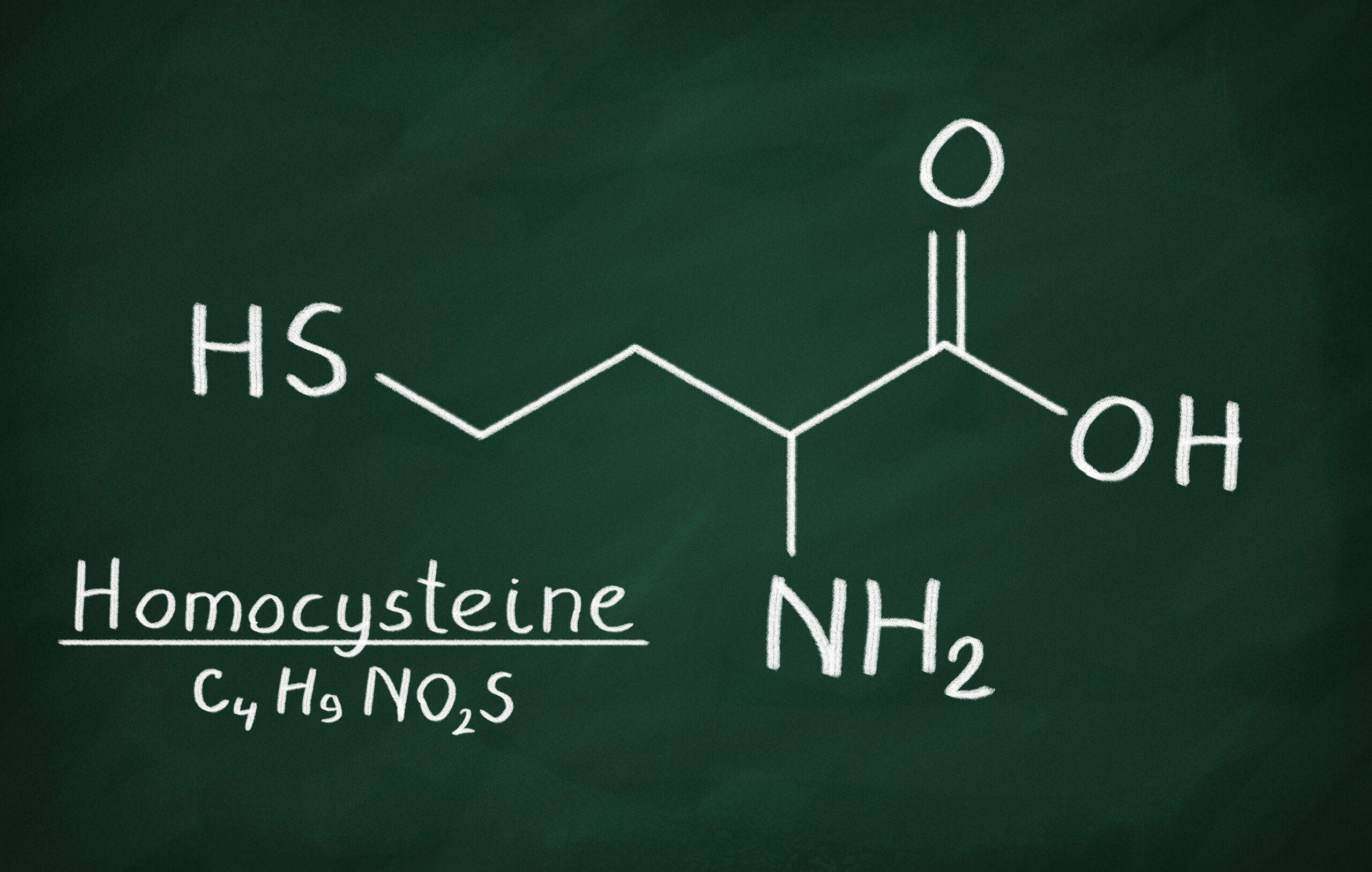 homocysteina