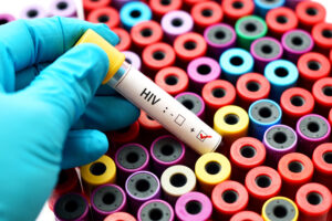 Wirus HIV