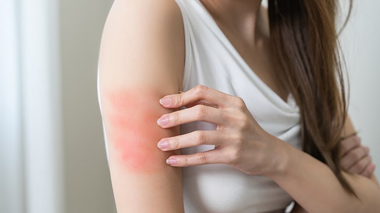 12 filarow zdrowia alergiczny atopowy
